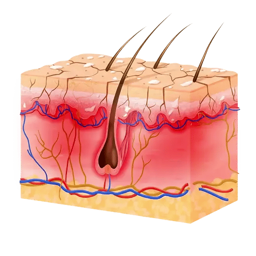 Trockene, gereizte Kopfhaut